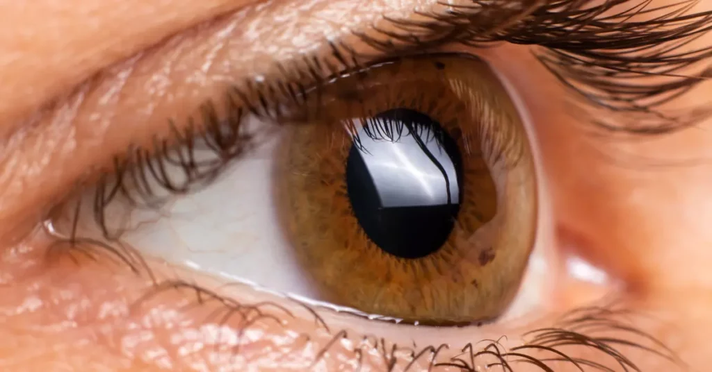 Causes of Corneal Ulcer