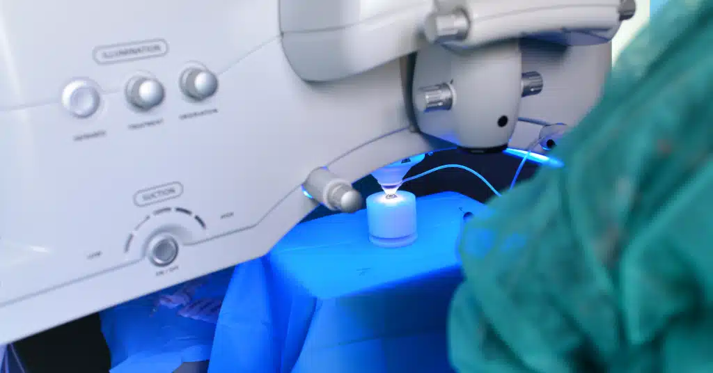 Cornea transplant