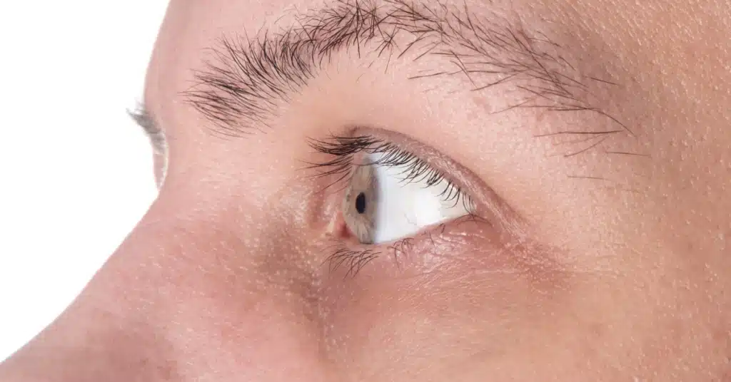 Eye Drops for Corneal Ulcers