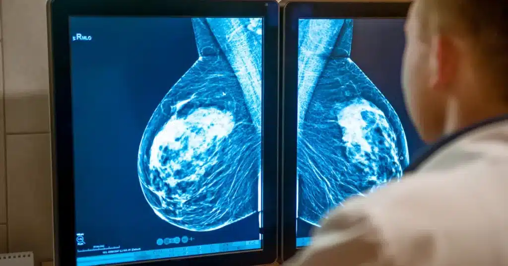 Mammograms examination