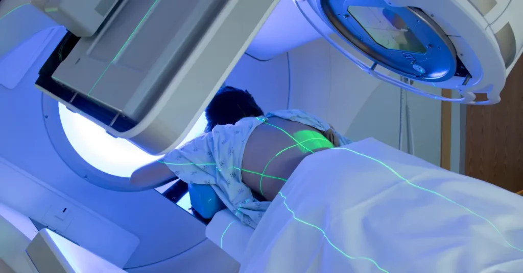 Radiation therapy