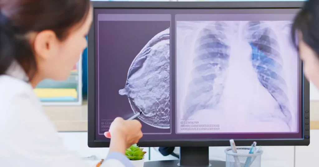 breast cancer symptoms