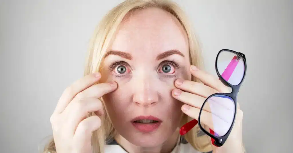 women with dry eyes