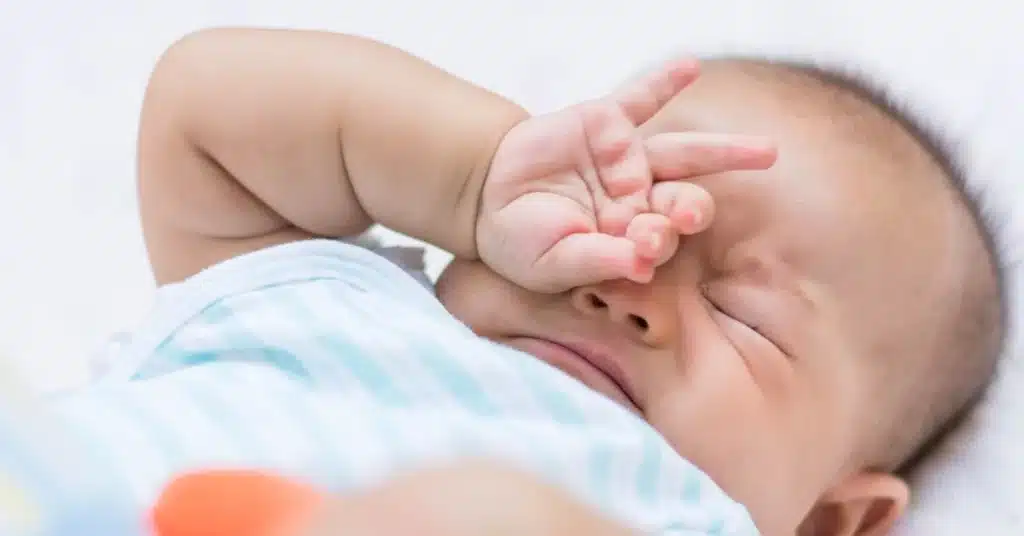 Baby eye infection yellow discharge