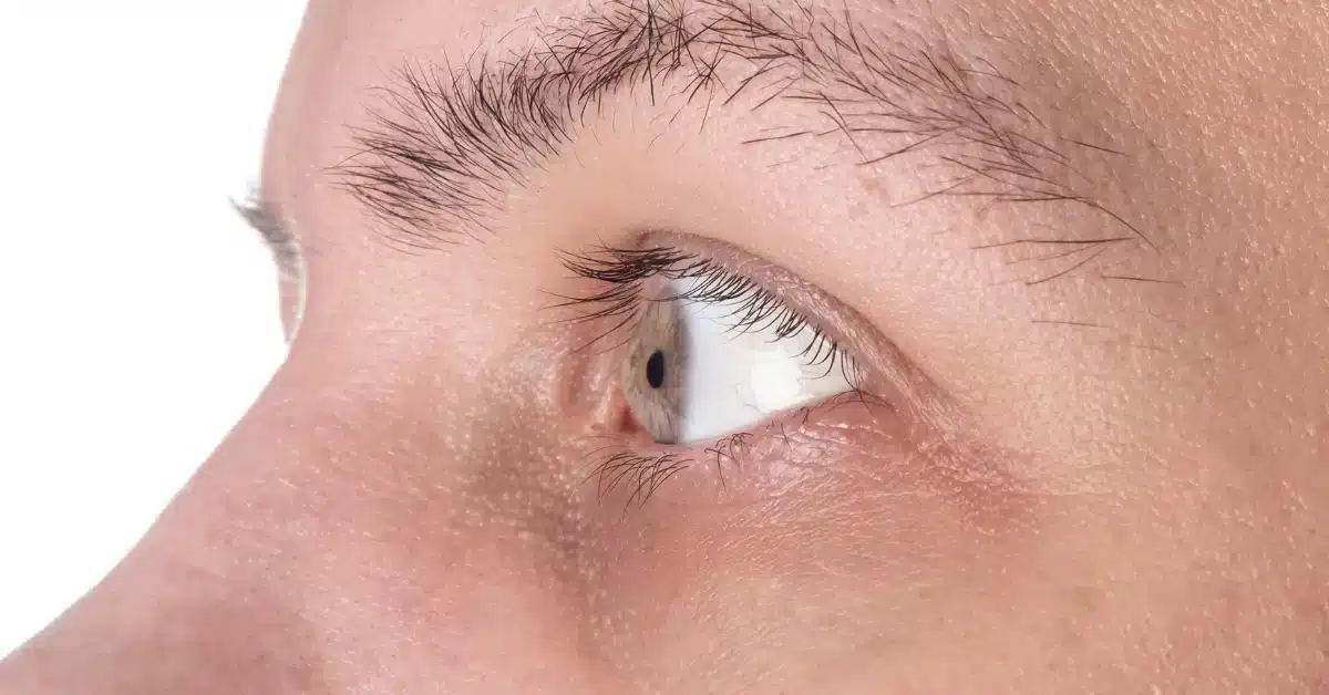Eye Drops for Corneal Ulcers