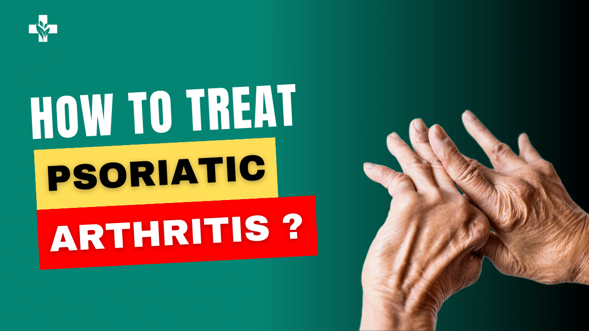 Psoriatic Arthritis Treatments Medications & Other Remedies