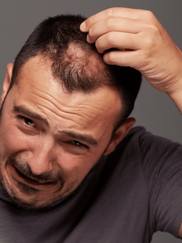 What Is Retrograde Alopecia? All Ins and Outs