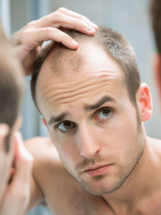 6 Strategies on How to Fix Balding Spots Naturally