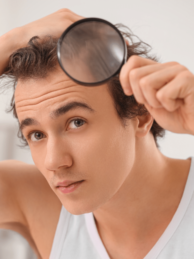 Top Signs of Balding at 20 You Always Overlook