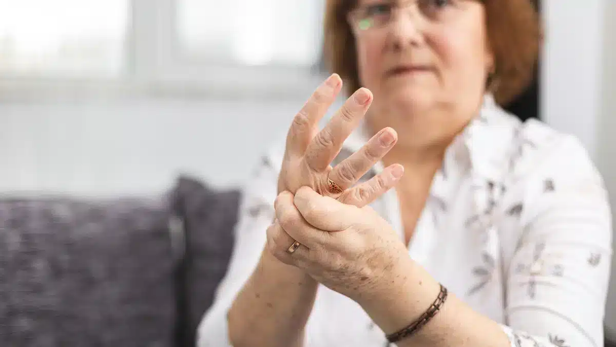 Does Rheumatoid Arthritis Cause Hair Loss? Uncovering the Hair Loss Dilemma