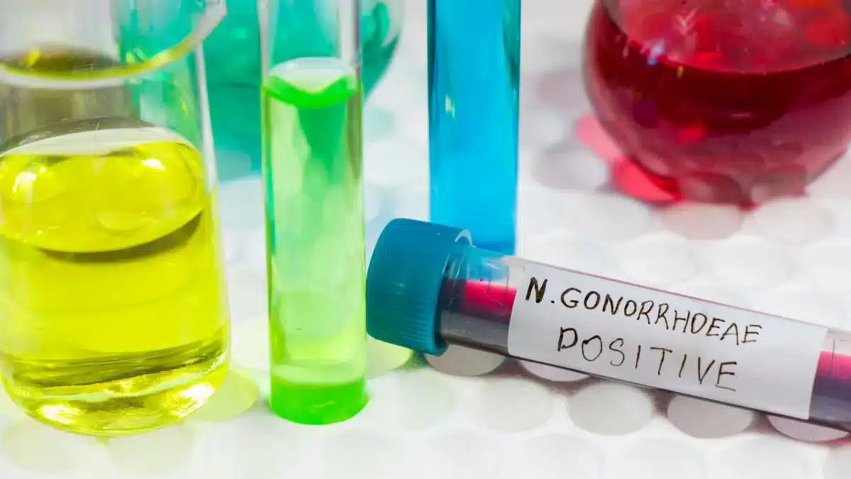is gonorrhea bacterial or viral