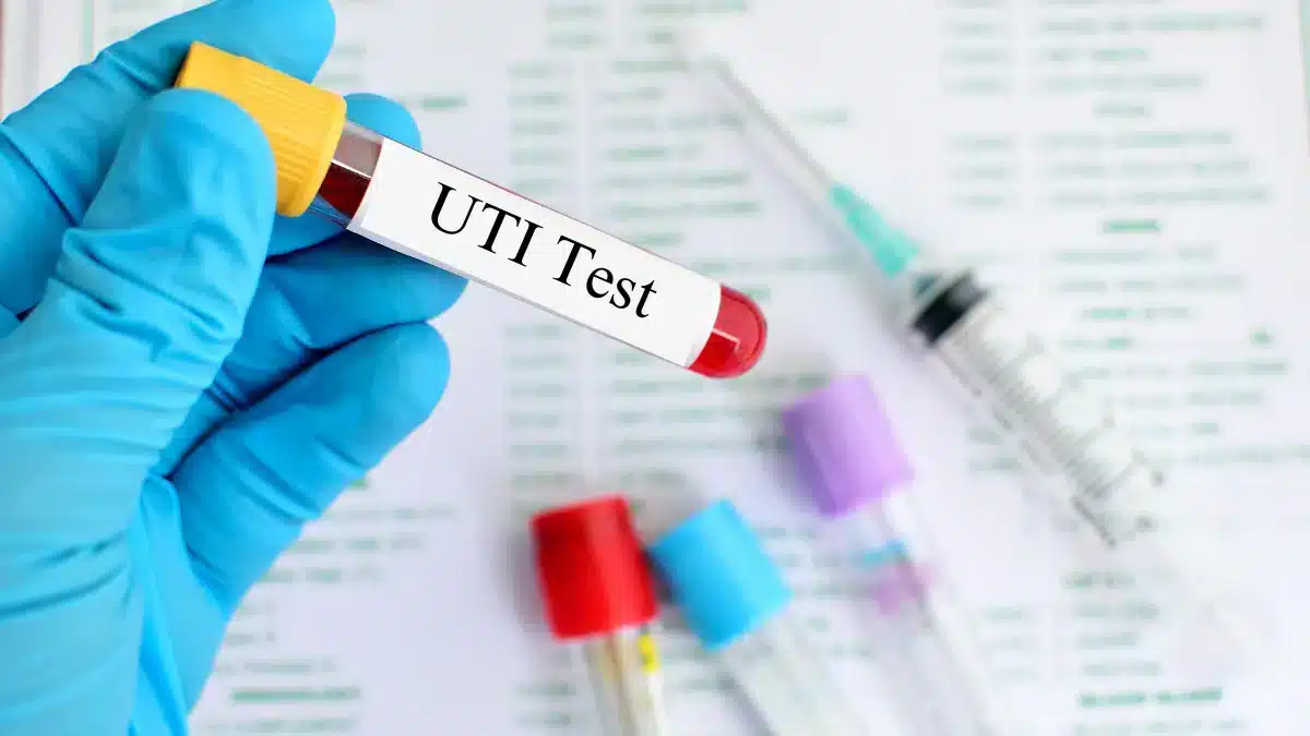 over-the-counter uti test