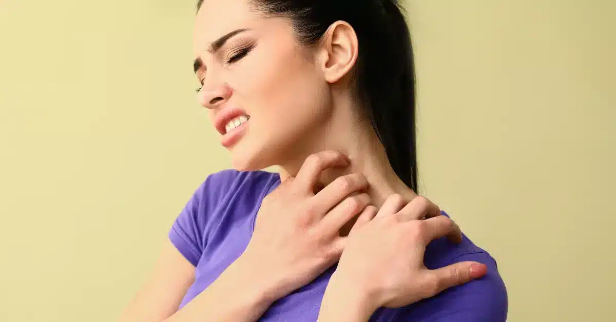 skin rashes in patients